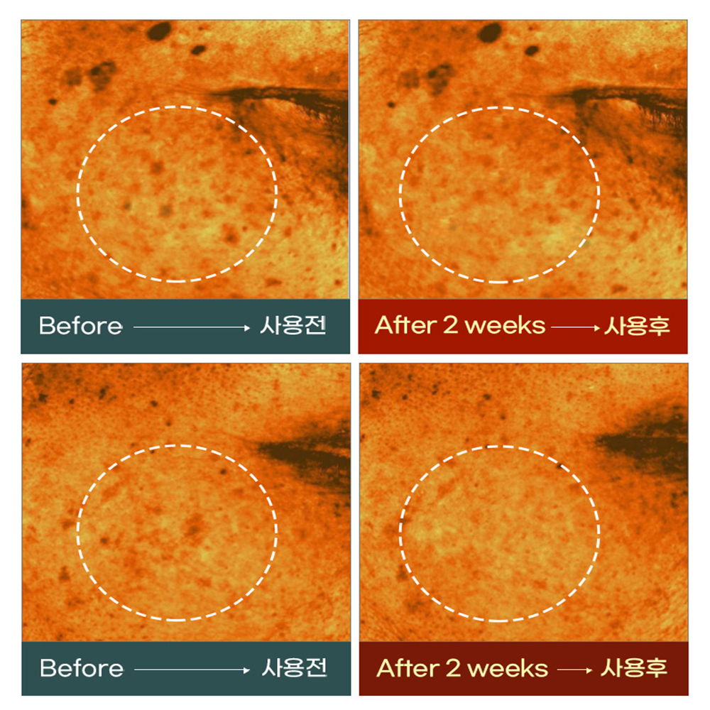 여드름피부 민감피부 시카 병풀 바하 색소침착 진정크림 올그린톡스솔루션 50ml, 1개 이미지 6