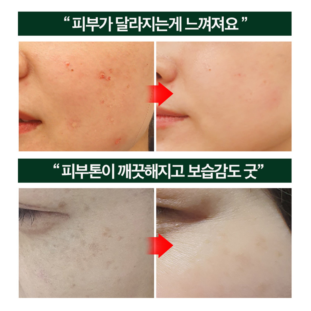 여드름피부 민감피부 시카 병풀 바하 색소침착 진정크림 올그린톡스솔루션 50ml, 1개 - 상세 이미지 2