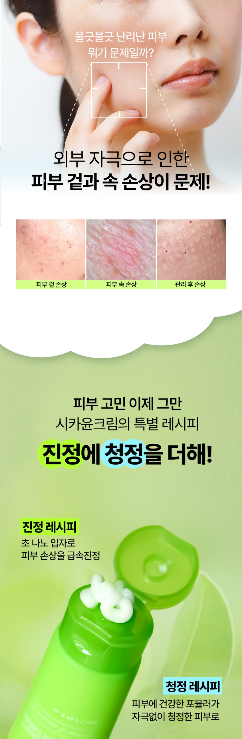 시카윤 크림 피부과 재생관리후 유황 레이저 관리후 50ml, 1개 판매처 상세 정보 이미지 4