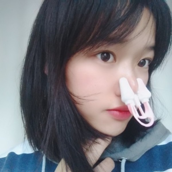 3D 노즈업 코집게 노즈업 코뽕 콧볼 축소 콧대 높이기 코높이 - 상세 이미지 4