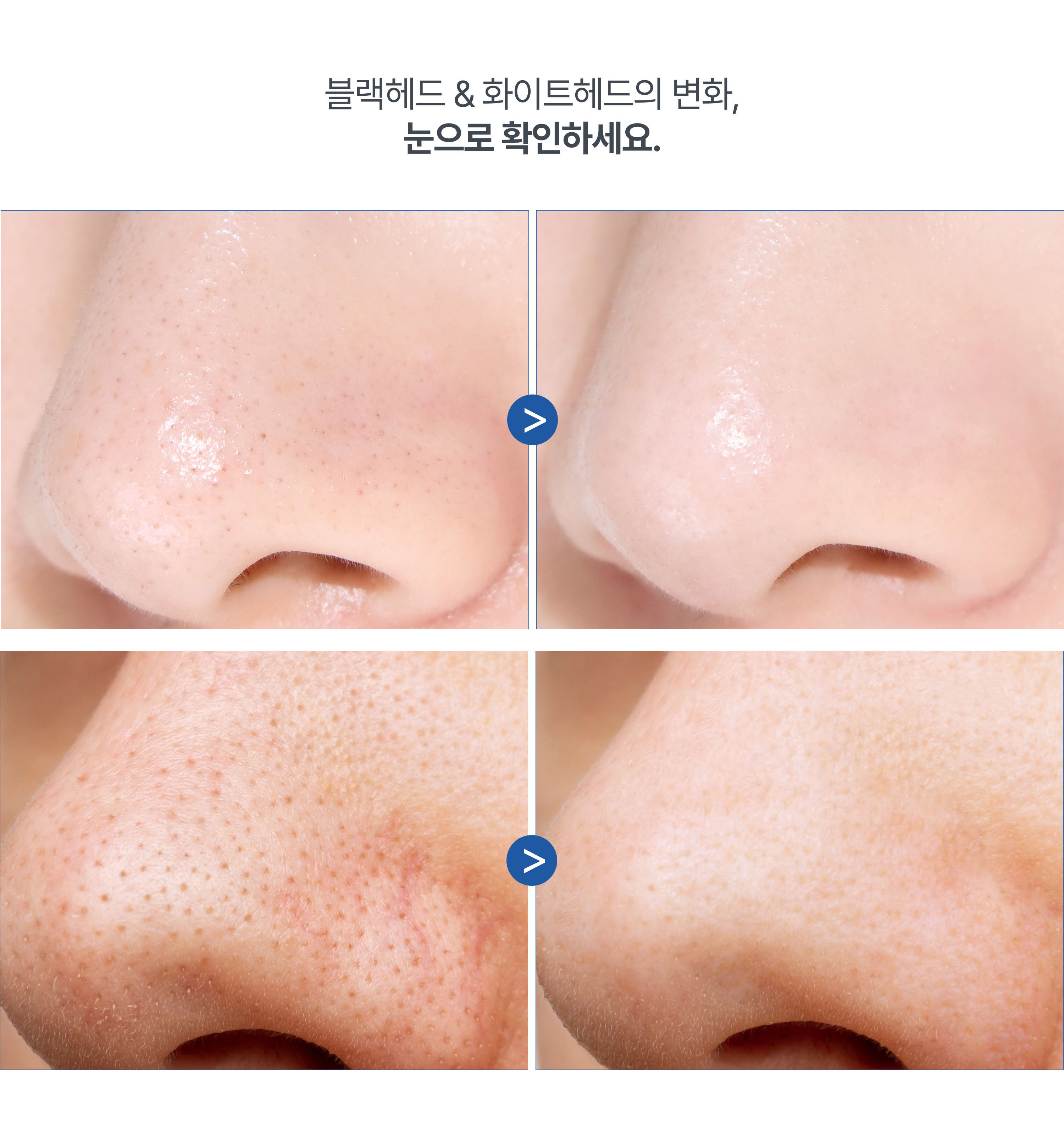 korean cleansing balm phyton squalane blue