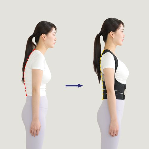 자세교정밴드 벨트 등 교정기 라운드숄더 어깨 바른자세 목 척추 말린 굽은 체형 허리 - 상세 이미지 2