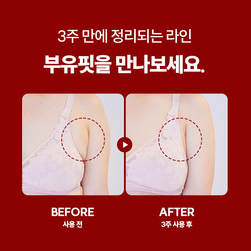 부유핏 부유방 제거기 림프 순환 마사지 겨드랑이 팔뚝 괄사 마사지기 - 상세 이미지 2