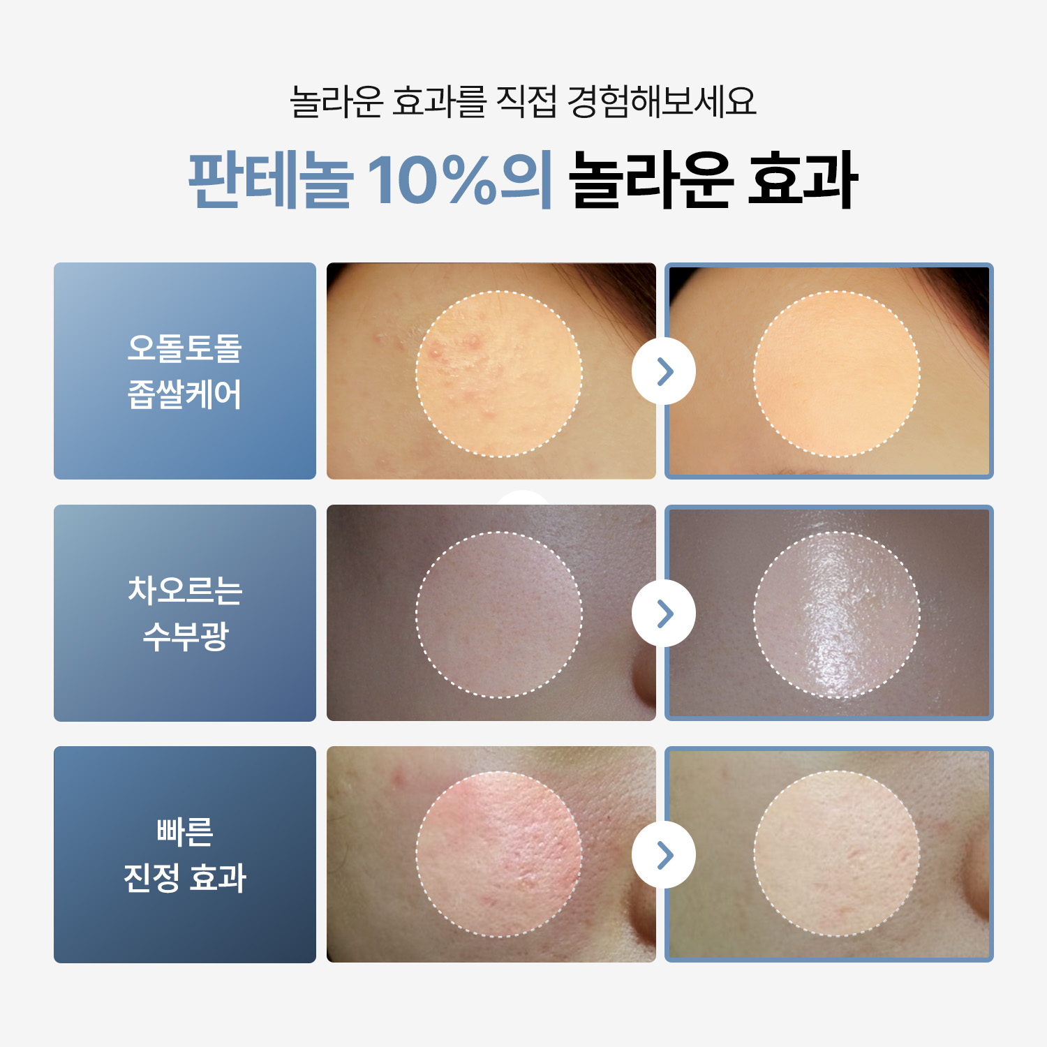 [투데이위드] 판테놀 10% 장벽 수분크림 120ml - 상세 이미지 2