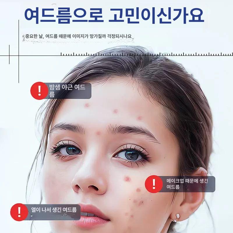 솔비에 별여드름패치 패치 여드름패치 트러블 스틱 레이저스타 해결 - 상세 이미지 3