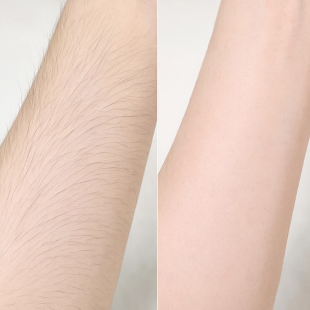 셀프 겨드랑이 제모 크림 종아리 다리 털 제모 크림 이미지 7