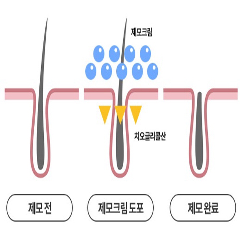 셀프 겨드랑이 제모 크림 종아리 다리 털 제모 크림 - 상세 이미지 5
