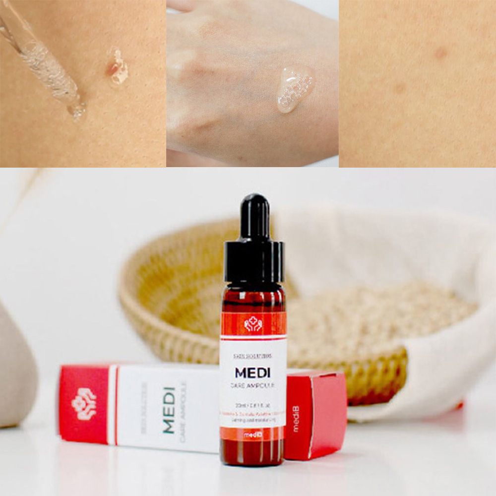 각질 제거 앰플 발톱 뒷꿈치 굳은살 갈라짐 건조 보습제