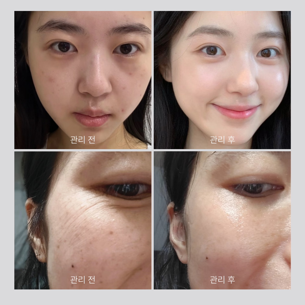 PDRN 앰플 고함량 피디알엔 바이옴 69% 히알루론산 모공 스킨부스터 30ml, 3개 이미지 3