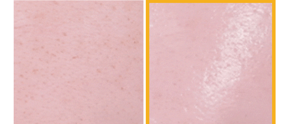 sungboon editor collagen patches