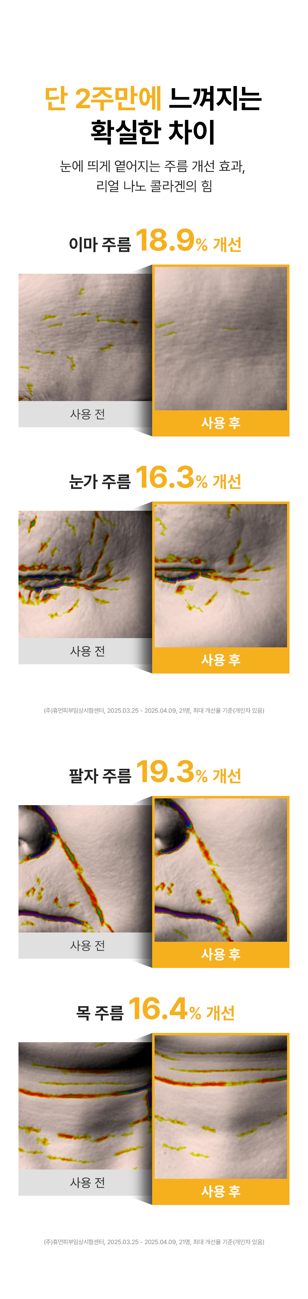 sungboon editor collagen patches