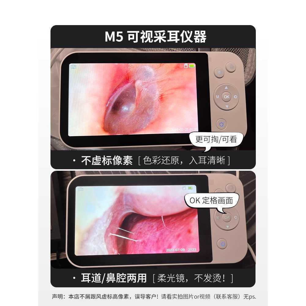 귀이개 내시경 LED 카메라 귀지 핀셋 셀프 청소 파개 - 상세 이미지 3