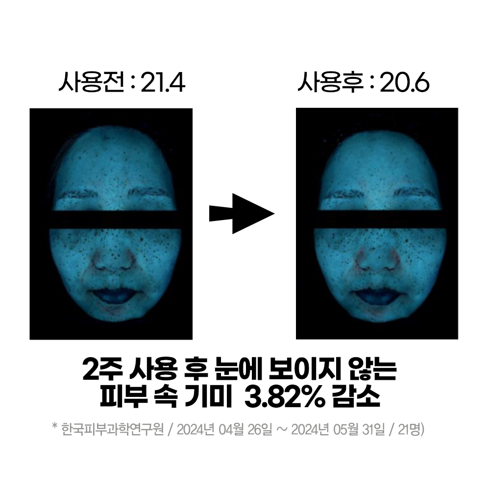 (기미 잡티, 색소침착 개선) 임상완료 수블랑 드리미 브라이트닝 앰플 15ml x 3개 - 상세 이미지 4