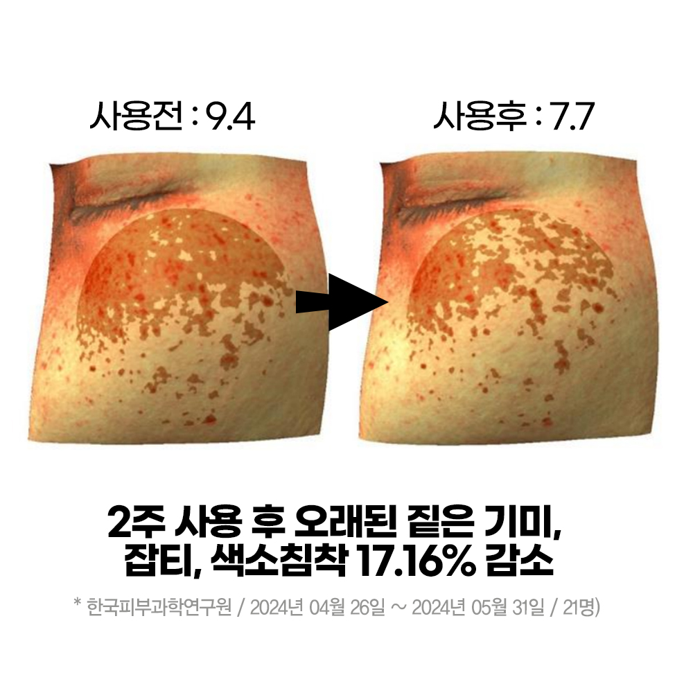 (기미 잡티, 색소침착 개선) 임상완료 수블랑 드리미 브라이트닝 앰플 15ml x 3개 - 상세 이미지 2