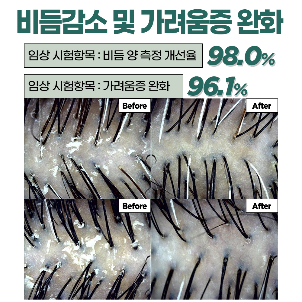 (비듬케어+두피가려움진정+탈락모발 개선+저자극 임상완료) 수블랑 래피드 프레쉬 딥 제주허브 샴푸 - 상세 이미지 2