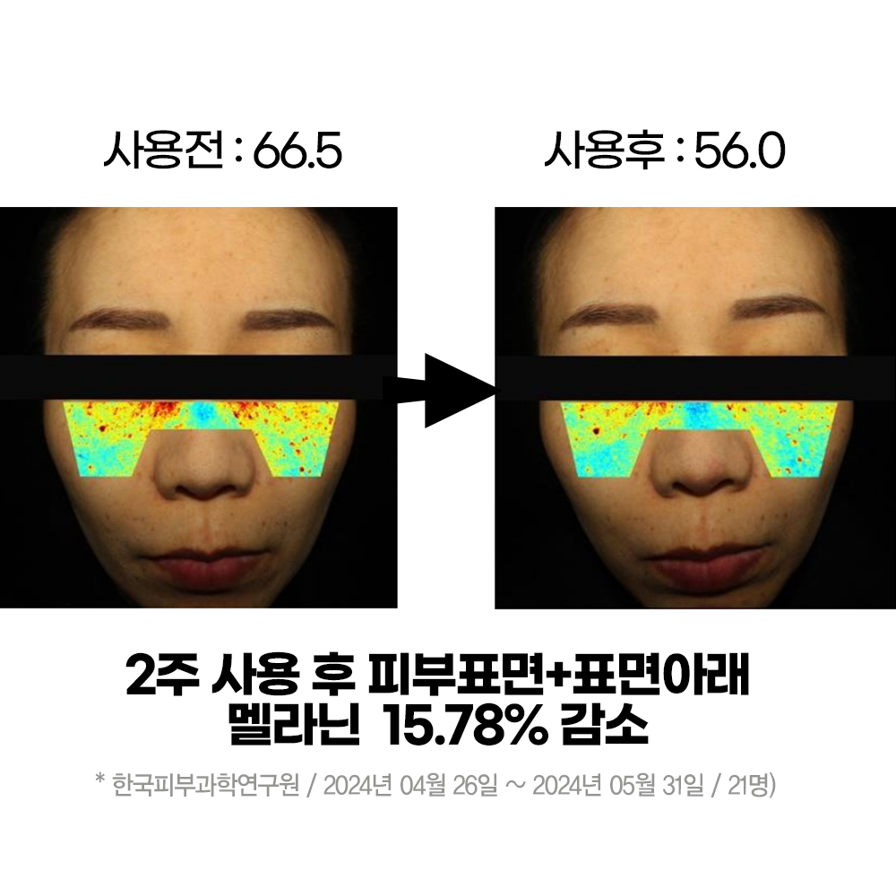 (기미 잡티, 색소침착 개선) 임상완료 수블랑 드리미 브라이트닝 앰플 15ml x 3개 - 상세 이미지 3