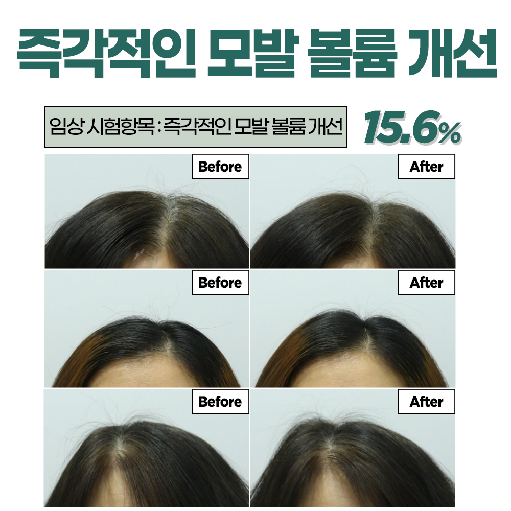 (비듬케어+두피가려움진정+탈락모발 개선+저자극 임상완료) 수블랑 래피드 프레쉬 딥 제주허브 샴푸 - 상세 이미지 4