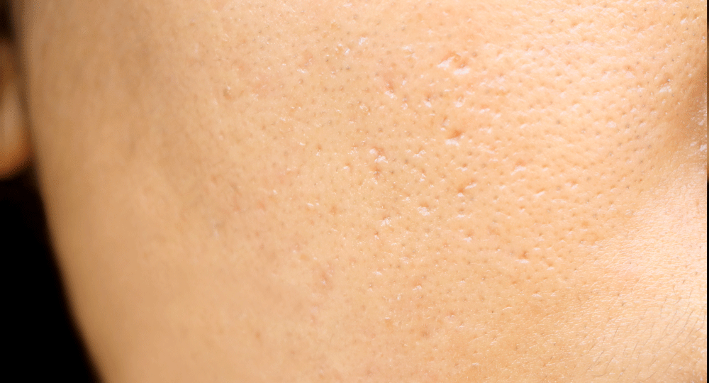 sungboon editor marine spicules wash off mask
