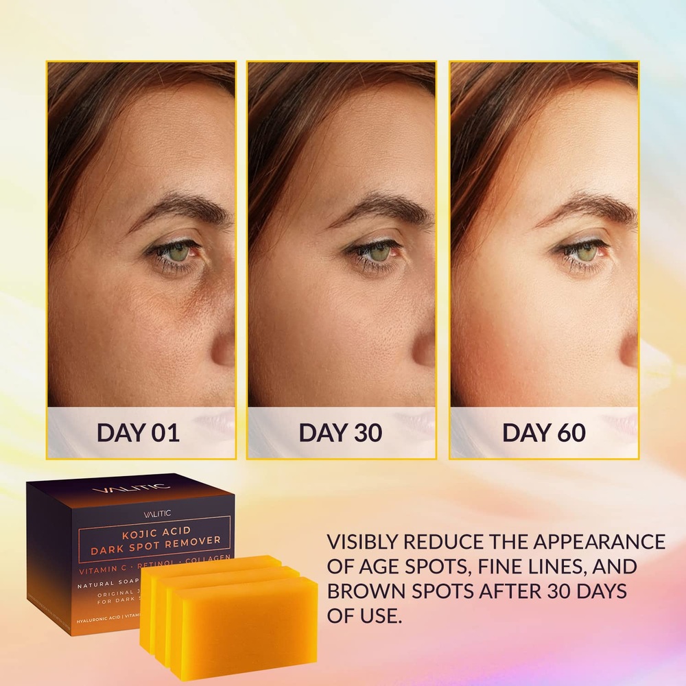 VALITIC KOJIC 발리틱 다크스팟 비누 올리브오일비누 시아버터 - 상세 이미지 2