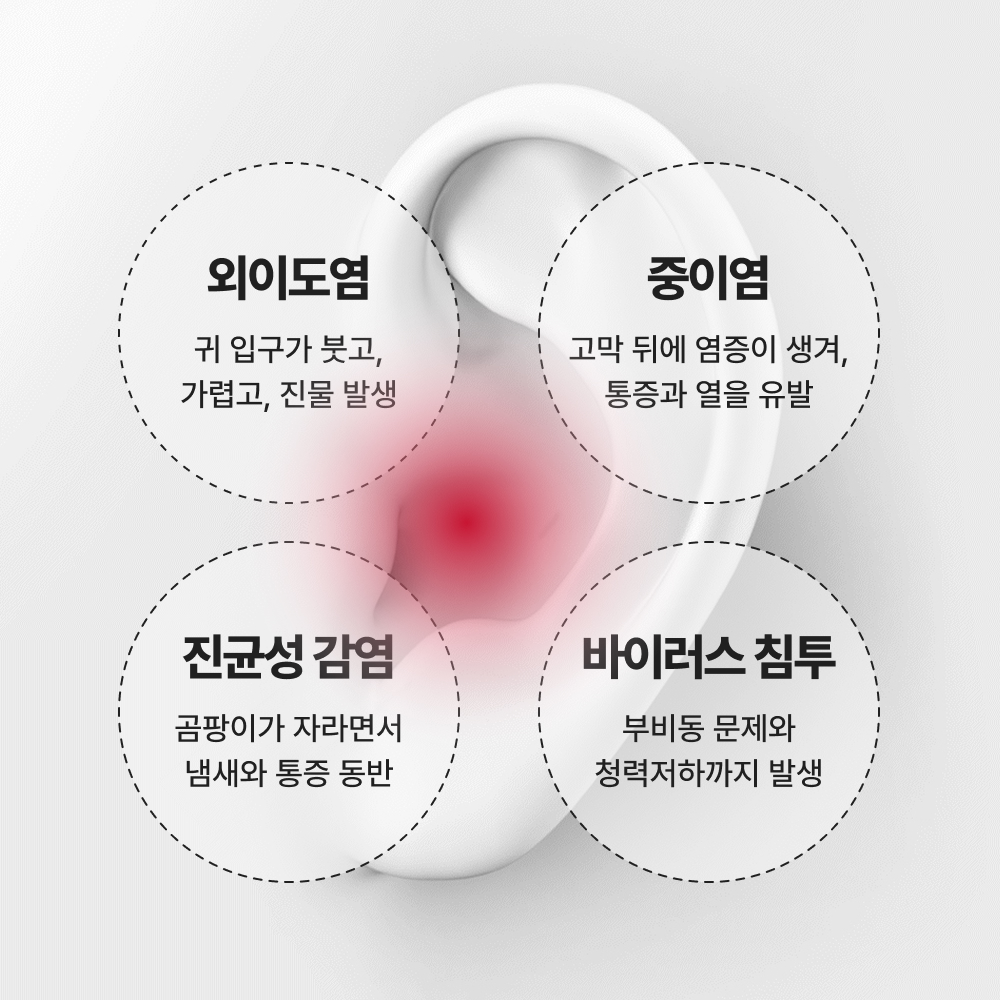 노이즈랩 수면귀마개 소음방지귀마개 층간소음차단 이어플러그 실리콘 군대 군인 사격 비행기