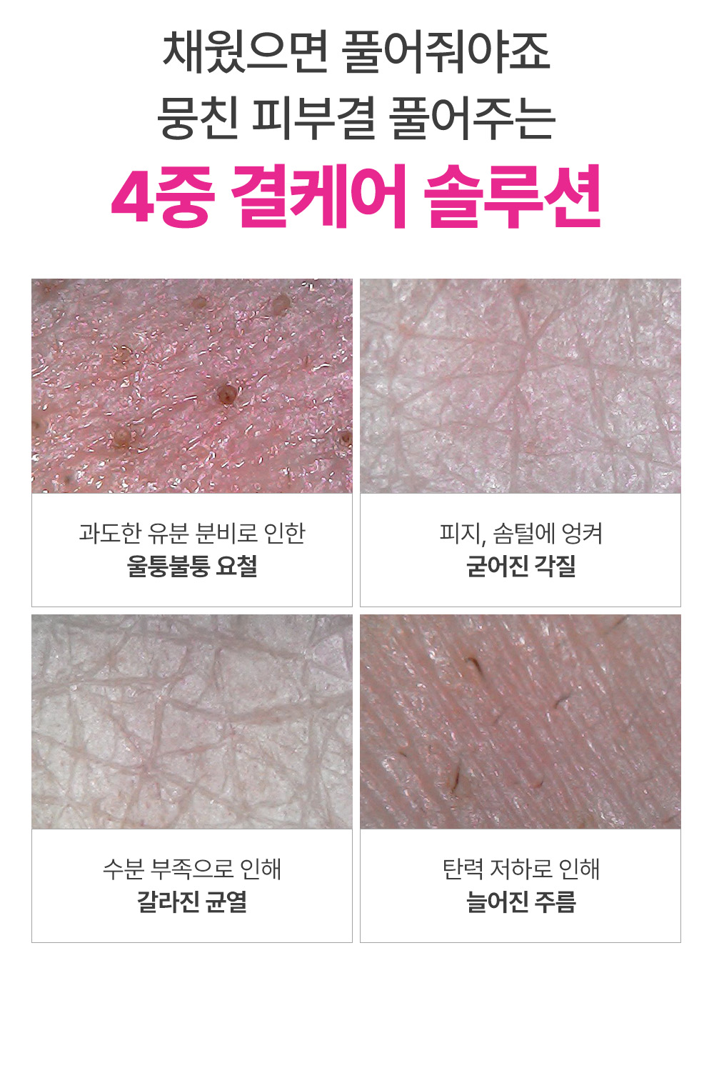 sungboon editor apple peel toner