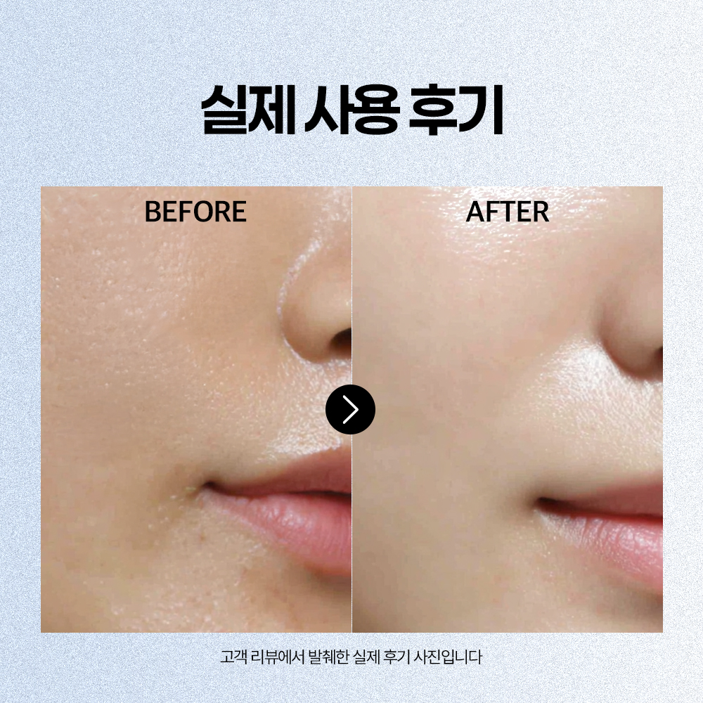 [도착보장] 에필로우 부활초 10중 히알루론산 펩타이드 앰플 / 속수분 탄력 세럼 50ml, 1개 - 상세 이미지 4
