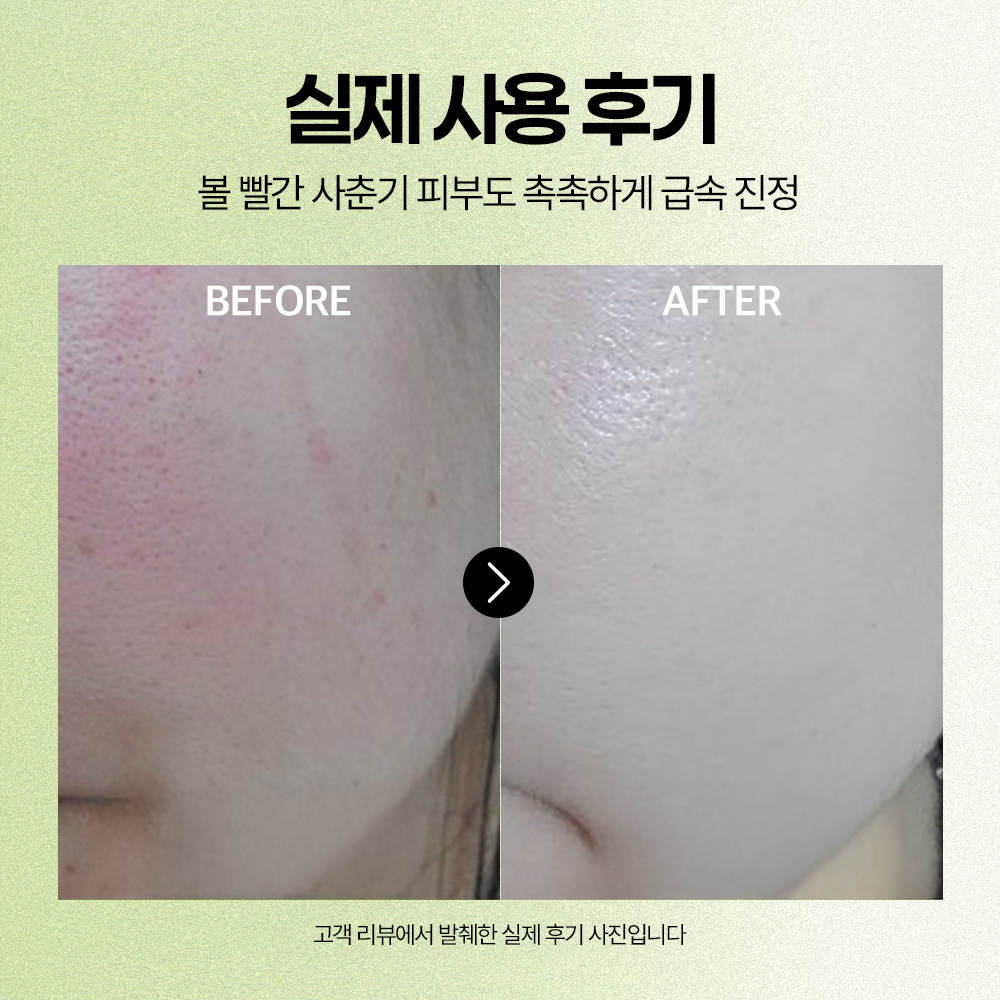 [도착보장] 에필로우 아티초크 시카 진정 앰플 / 저자극 흔적케어 장벽개선 세럼 50ml, 1개 - 상세 이미지 4