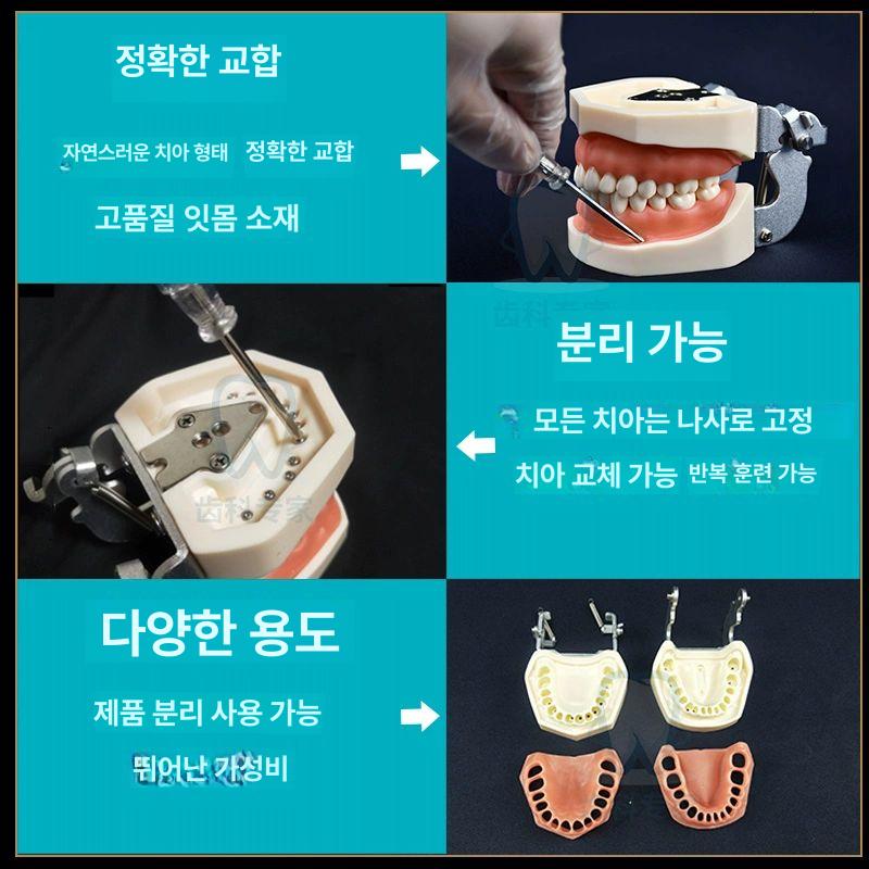 모델 구강 실습 분리 덴티폼 모형 스케일링 이빨 잇몸 부드러운 잇몸 모델 28개 치아 - 상세 이미지 3