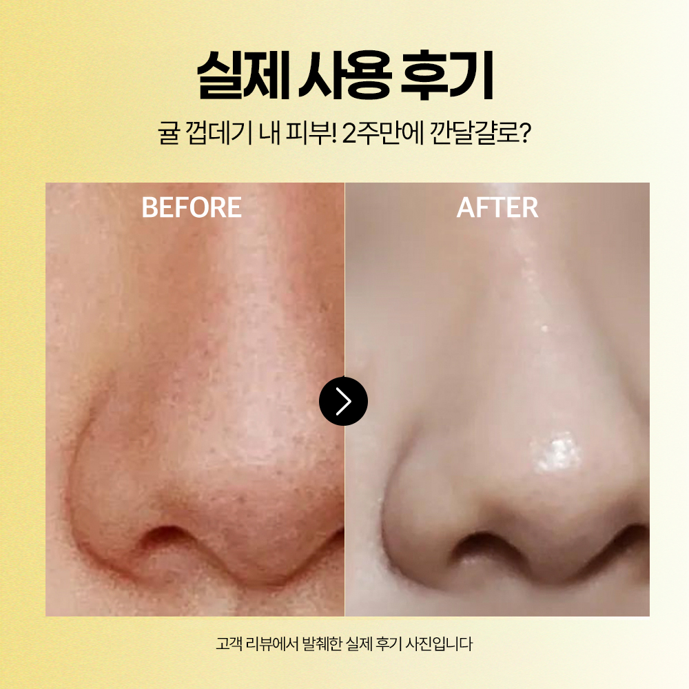 모공 앰플 추천 깐달걀피부 에필로우 차가버섯 모공 세럼 사용후기