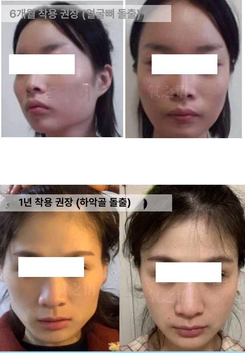 얼굴 마사지 도구 괄사기 안면 관리 손쉬운 경락기구 핑크 밴드포함 - 상세 이미지 4