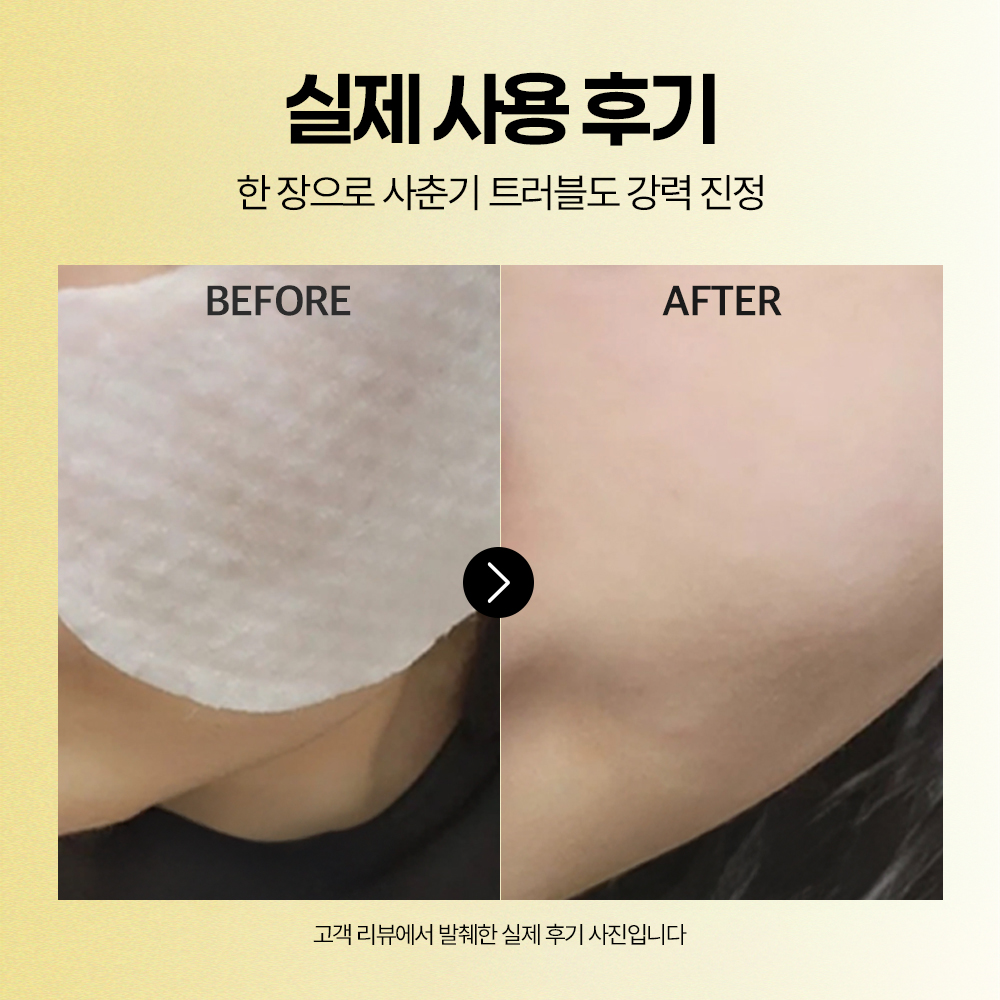 [도착보장] 에필로우 차가버섯 LHA 모공 각질 토너패드 / 저자극 피지케어 필링패드 70매, 1개 - 상세 이미지 5
