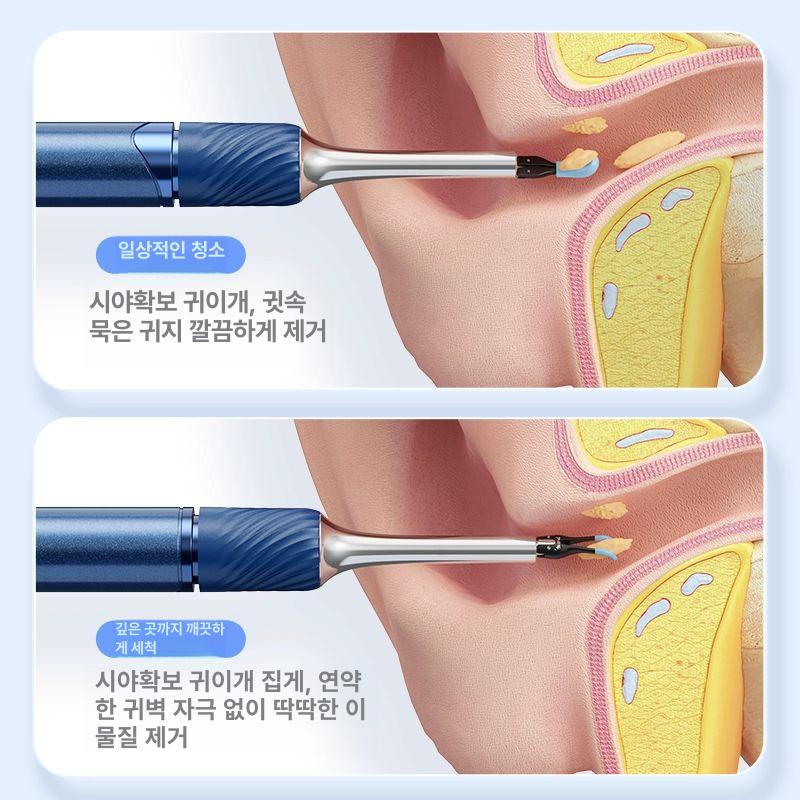 로봇팔 핀셋 귀이개 셀프 관리 귀파개 스푼 귀지 귓밥 S5-A 포함 블랙 비주얼 3-in-1 - 상세 이미지 5