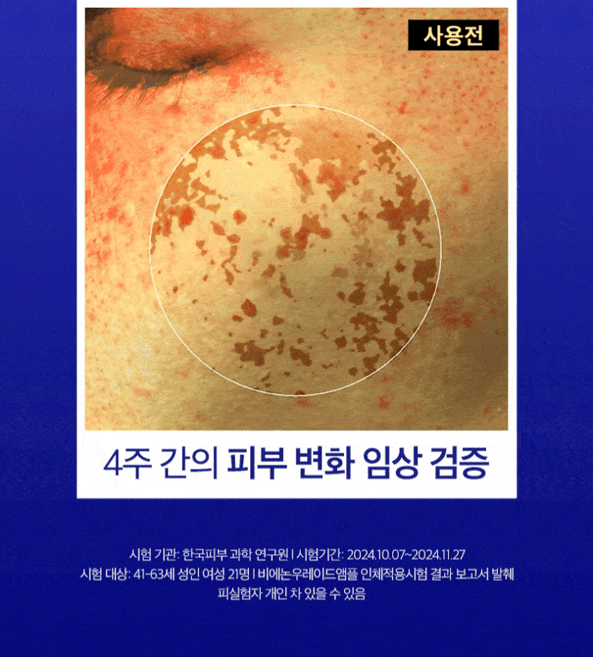 비에논 우레이드 기미앰플 검버섯 흑자 나이아신아마이드 미백앰플 판매처 상세 정보 이미지 3