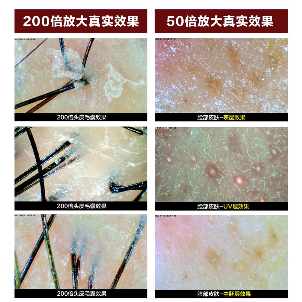 두피진단기 피부진단기 측정기 진단기 확대경 두피현미경 - 상세 이미지 3