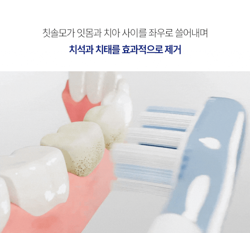 알로코리아 듀얼덴티 전동칫솔 ATA1S 좌우 회전 음파 완전방수 미세모 판매처 상세 정보 이미지 4