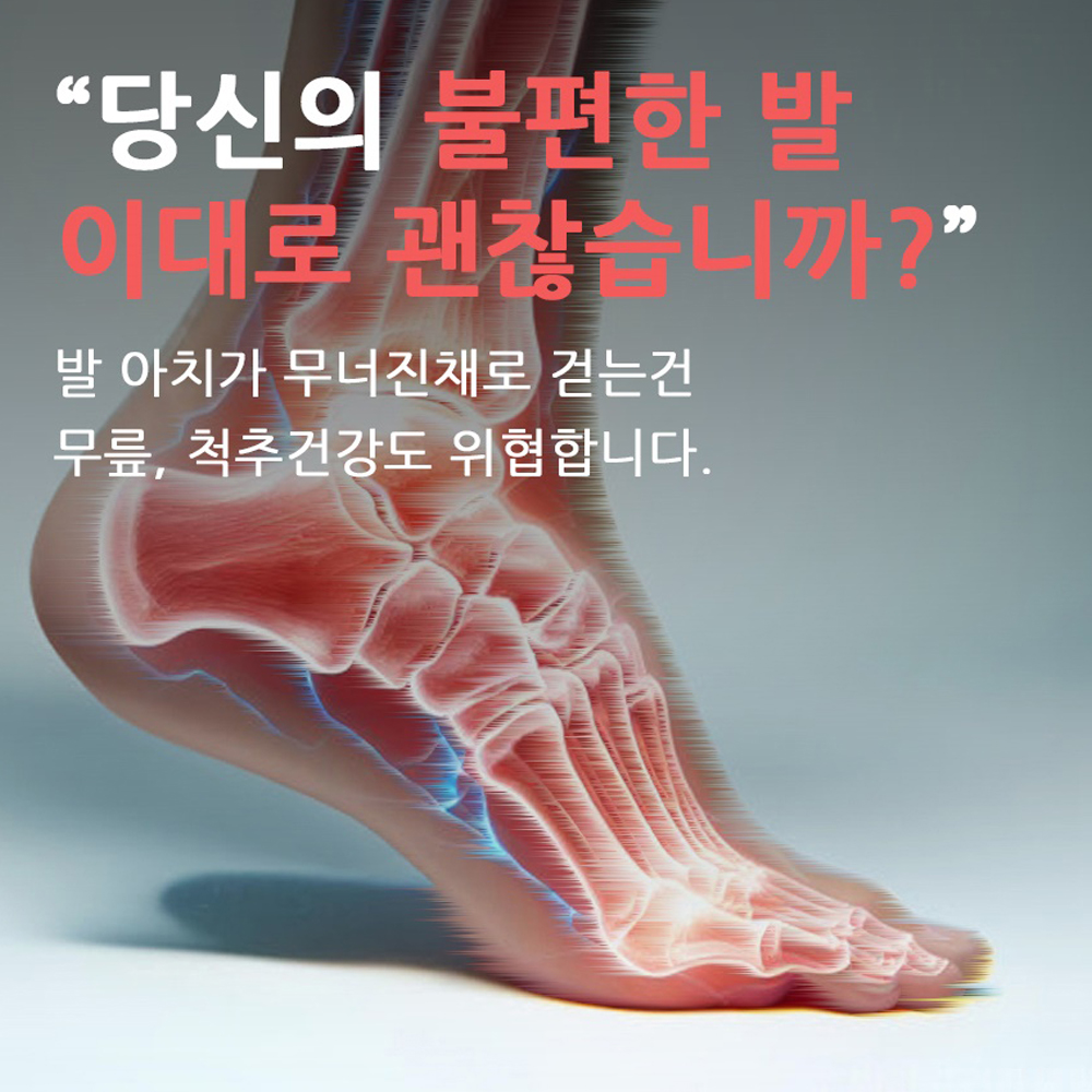 아치깔창 오다리 평발 지압 군화 인솔 발아치 기능성 아치형 3개 세트 - 상세 이미지 5