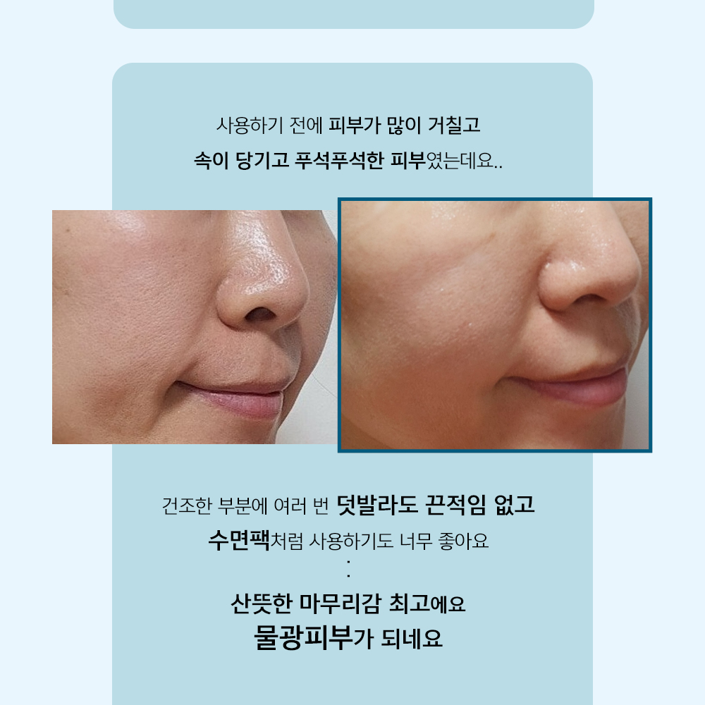 리더미스 악건성 극건성 속건조 수부지 기초 3종 50대 기초화장품 - 상세 이미지 5