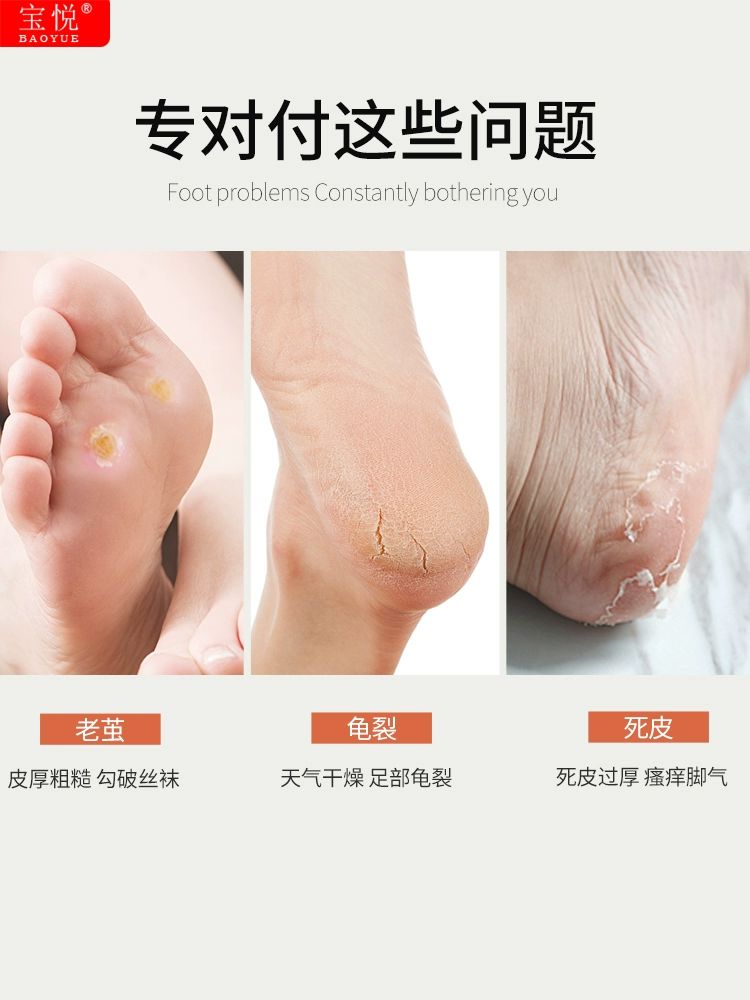 발뒤꿈치 사포 굳은살제거 발바닥각질 각질 발바닥 양면 사포 얇은 발바닥 스크래퍼 1개 - 상세 이미지 5