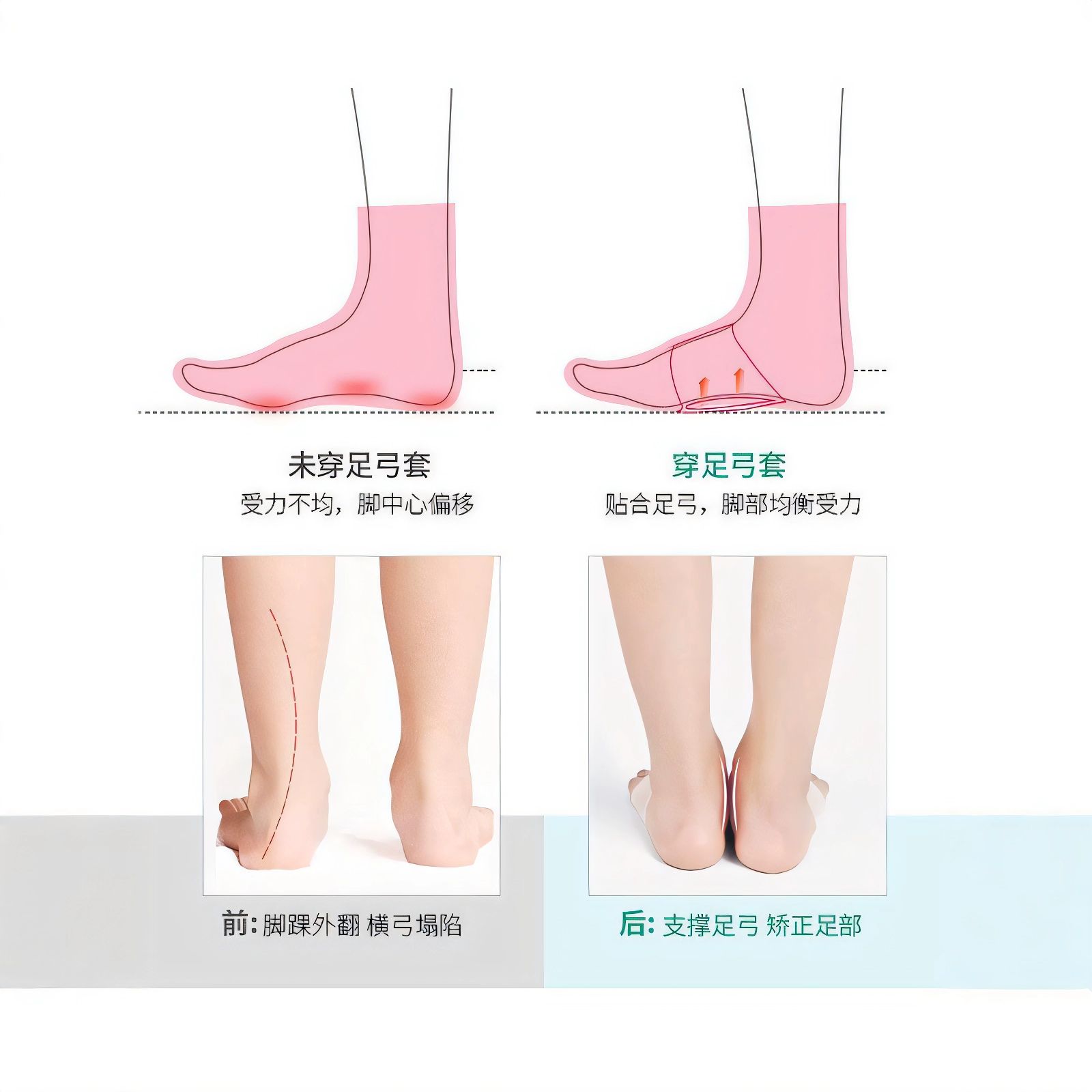 아치실내화 평발실내화 발아치 패드 평발용 실리콘 보호 1개 시 증정 1개 화이트 2개 발 근막 불편 전용 - 상세 이미지 4
