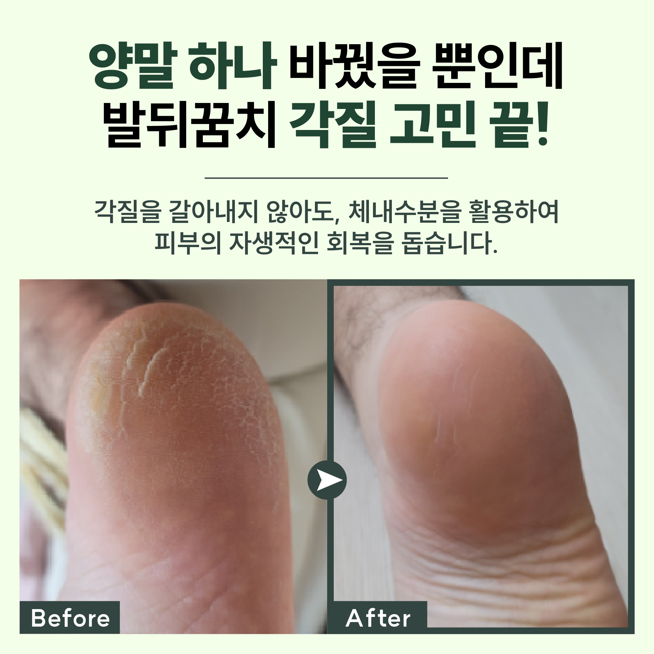 [6 SET] 보스비 블렌디드 보습양말 6켤레 묶음 이벤트 - 상세 이미지 3