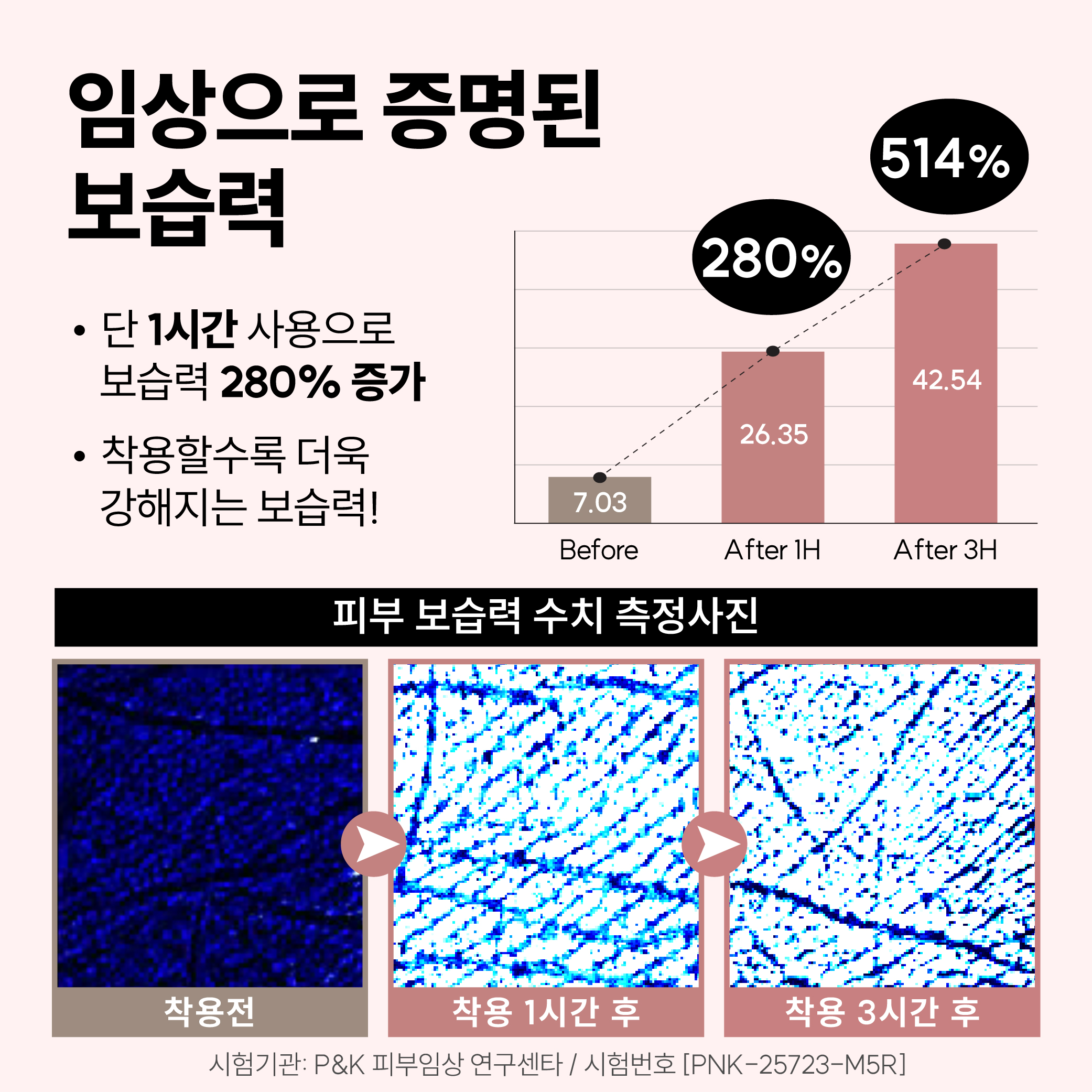 보스비 [스킨힐캡] 단품 실리콘 풋패드 발뒤꿈치 발꿈치 발바닥 통증 갈라짐 N배송 - 상세 이미지 4