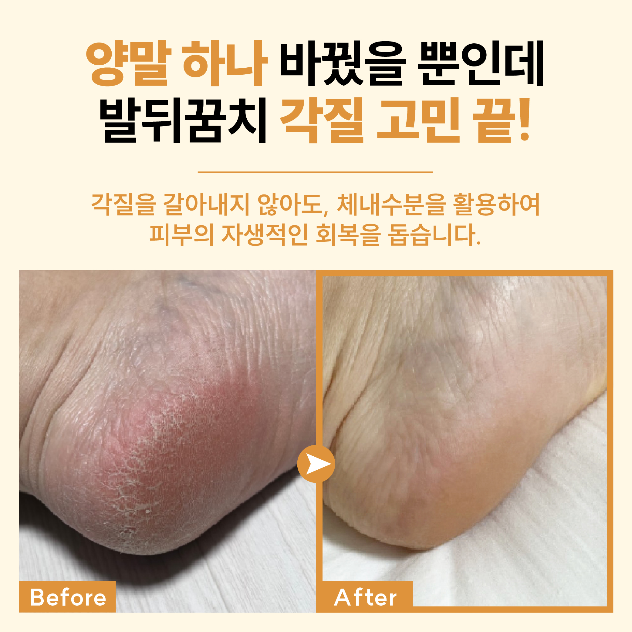 [3 SET] 보스비 베이직 보습양말 3켤레 기획세트 N배송 - 상세 이미지 4