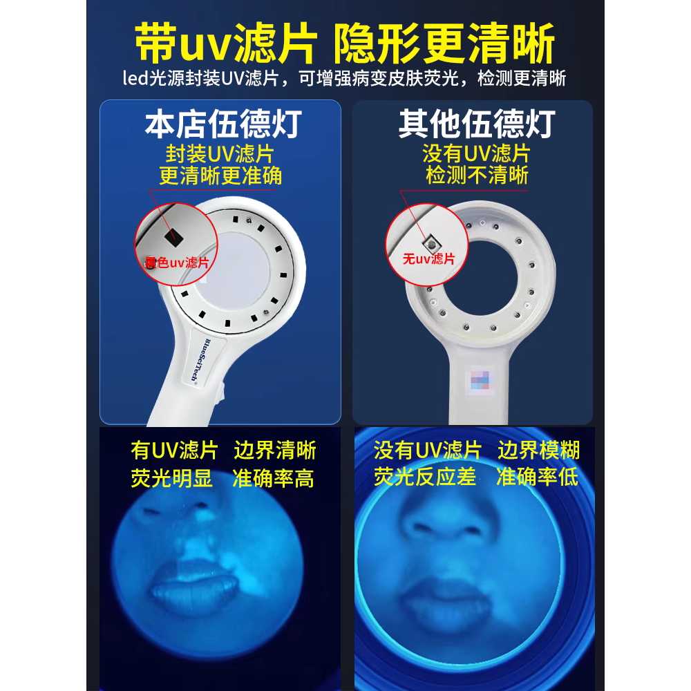 우드램프 확대경 진단 백선 UV 블랙라이트 피부 필터 - 상세 이미지 2