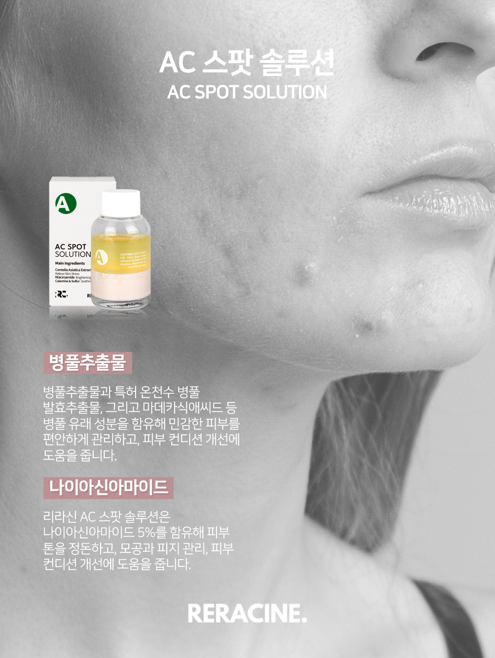 리라신 AC 스팟 솔루션 18ml+샘플 트러블 진정 케어 칼라민 흔적관리 - 상세 이미지 4