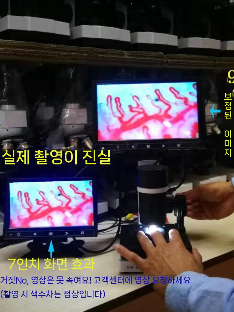 디지털 고배율 혈류 모세혈관 현미경 확대경 전자 초고화질 고화질 HD 표준 680배(7인치) - 상세 이미지 4