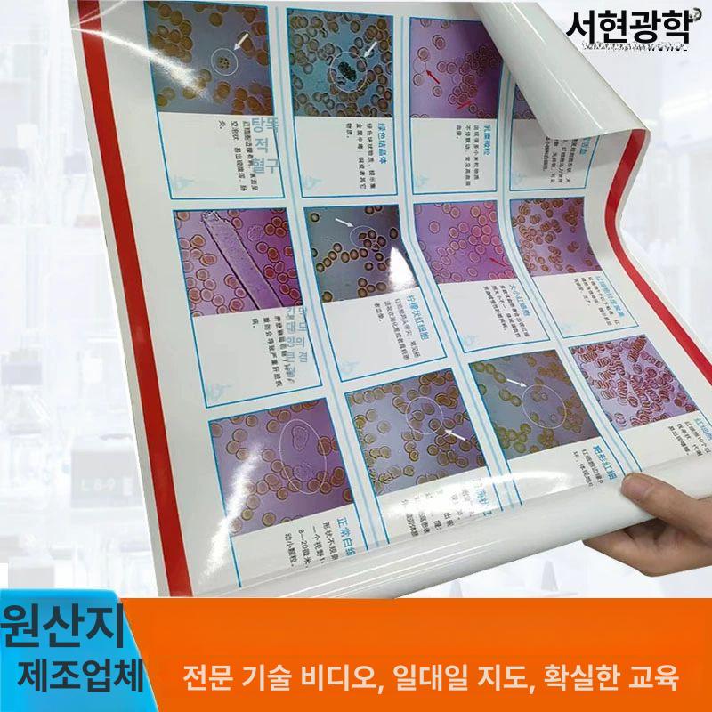 디지털 혈액 현미경 진드기 모세혈관 판독용 모니터 지질 디스플레이 적혈구 한 방울 혈액 검사기 TV형 - 상세 이미지 5