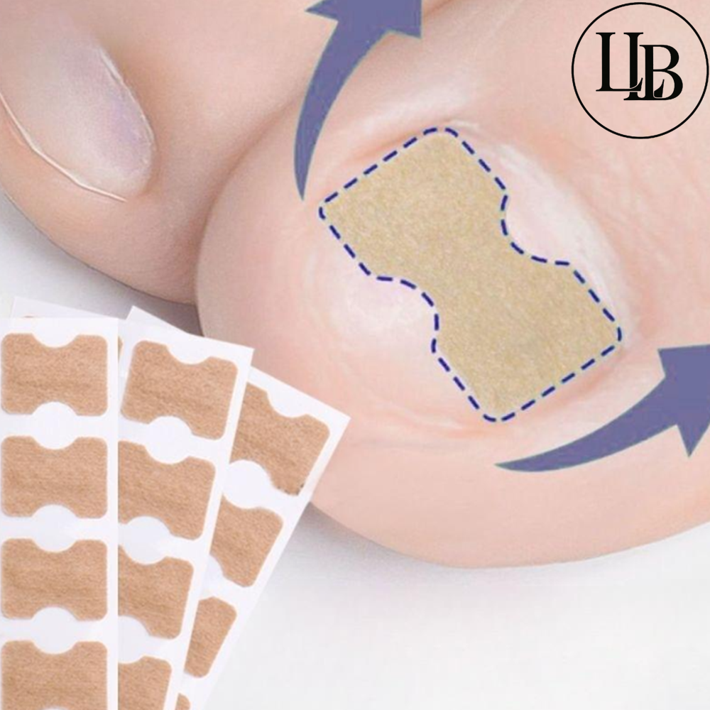 내성 발톱 파고드는 관리 도구 패치 테이프 엄지발가락 휨  10p