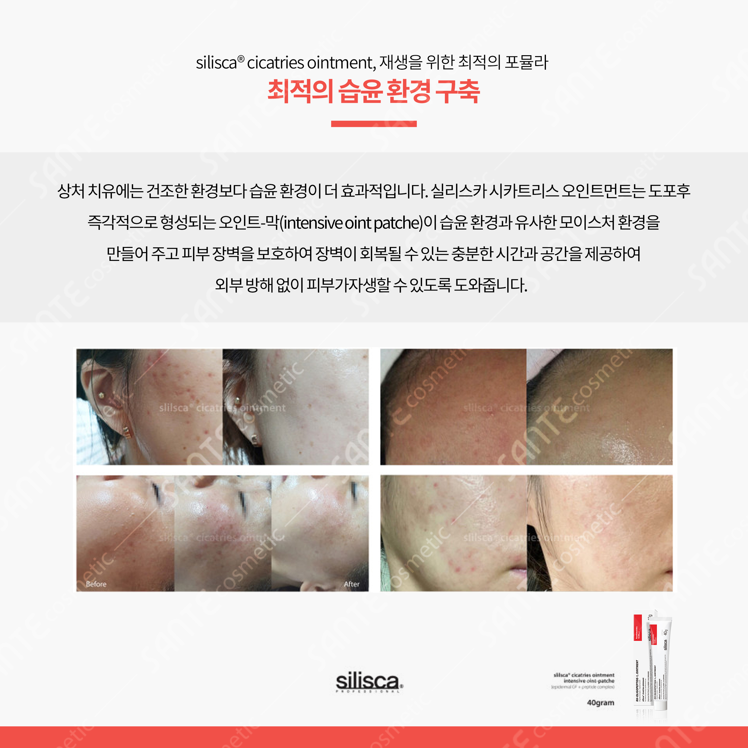 실리스카 시카트리스 오인트먼트 크림 40g 피부과 관리 후 물광보습 피부 장벽강화 - 상세 이미지 4