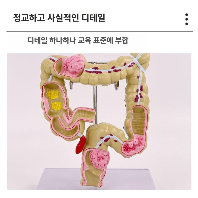 대장 해부학 모형 직장 위장 교구 병원 설명용 샘플 직장 모형 - 상세 이미지 3