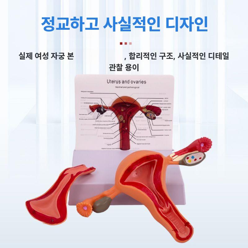산부인과 자궁모형 난소 여성 생식기 구조 교구 해부도 양측 난소 자궁 - 상세 이미지 2
